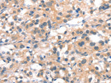CYP2D6 Polyclonal Antibody Store at -20°C