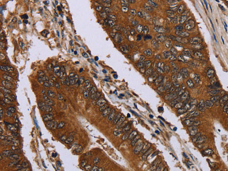 Catenin gamma Polyclonal Antibody Store at -20°C