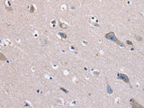 KCNQ5 Polyclonal Antibody Store at -20°C