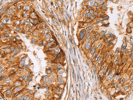 CD59 Polyclonal Antibody Store at -20°C