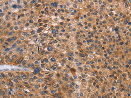 NIF3L1 Polyclonal Antibody Store at -20°C