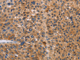 NIF3L1 Polyclonal Antibody Store at -20°C
