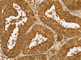 PDP1 Polyclonal Antibody Store at -20°C