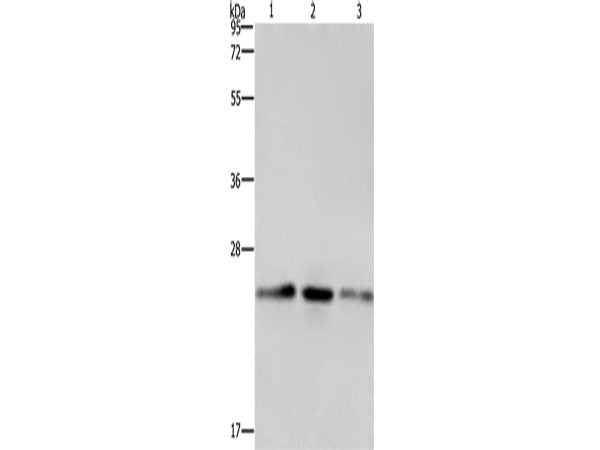 EMC8 Polyclonal Antibody Store at -20°C