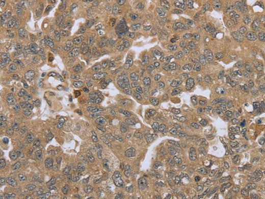 STMN2/3/4 Polyclonal Antibody Store at -20°C