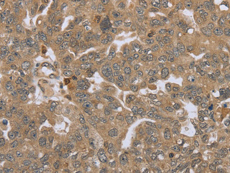 STMN2/3/4 Polyclonal Antibody Store at -20°C