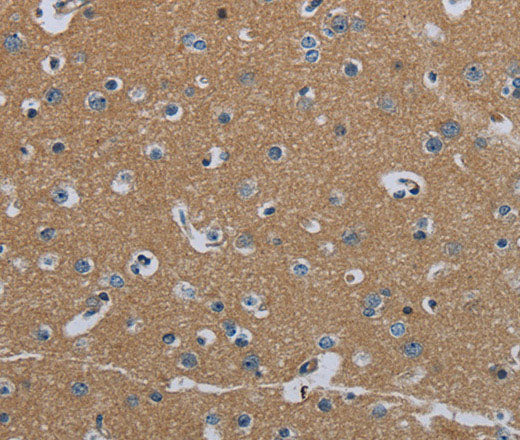 FAAH Polyclonal Antibody Store at -20°C