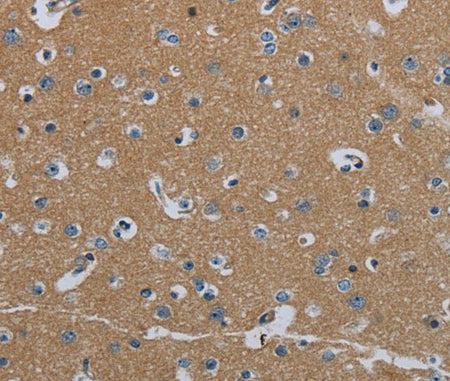 FAAH Polyclonal Antibody Store at -20°C