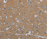 FAAH Polyclonal Antibody Store at -20°C