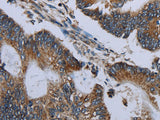 NDUFA13 Polyclonal Antibody Store at -20°C