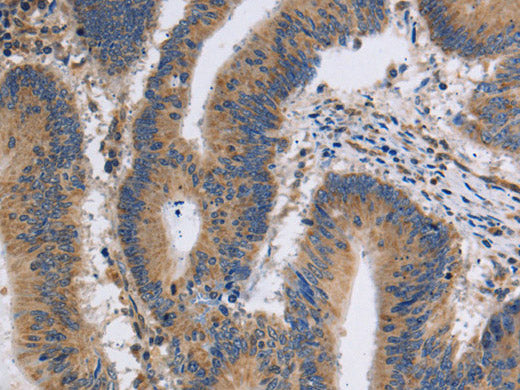 ITPR1 Polyclonal Antibody Store at -20°C
