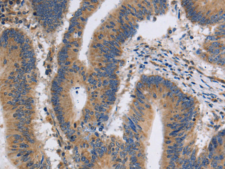 ITPR1 Polyclonal Antibody Store at -20°C