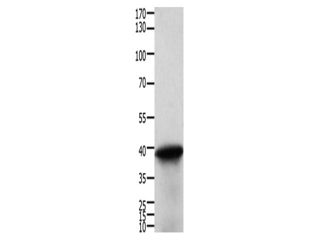 TPM2 Polyclonal Antibody Store at -20°C