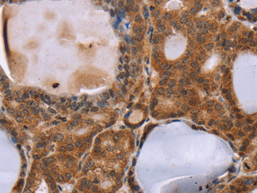 NDUFA2 Polyclonal Antibody Store at -20°C