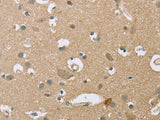 ECHS1 Polyclonal Antibody