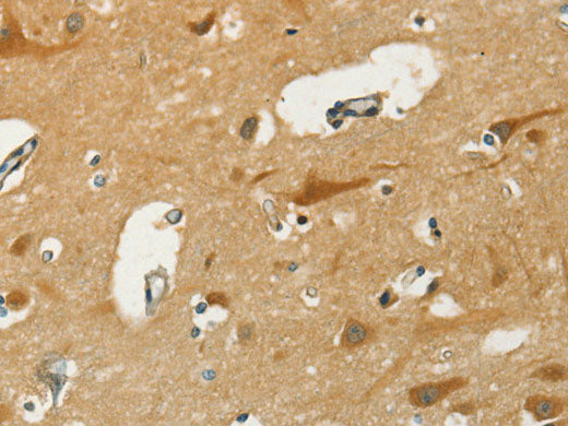 KLC1 Polyclonal Antibody Store at -20°C