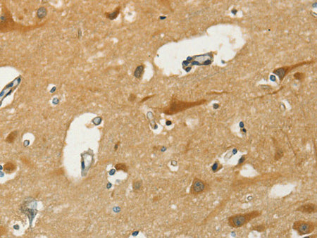 KLC1 Polyclonal Antibody Store at -20°C