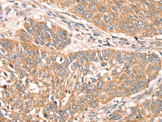 RPS6KA1 Polyclonal Antibody Store at -20°C