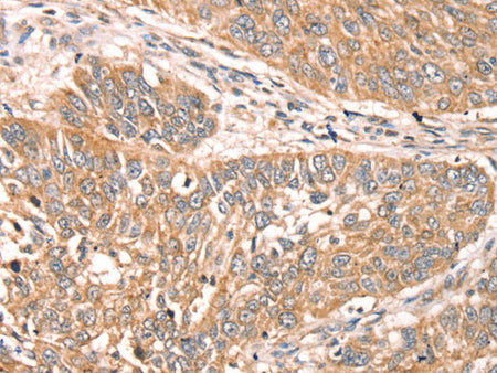 RPS6KA1 Polyclonal Antibody Store at -20°C
