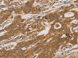 CYP17A1 Polyclonal Antibody Store at -20°C