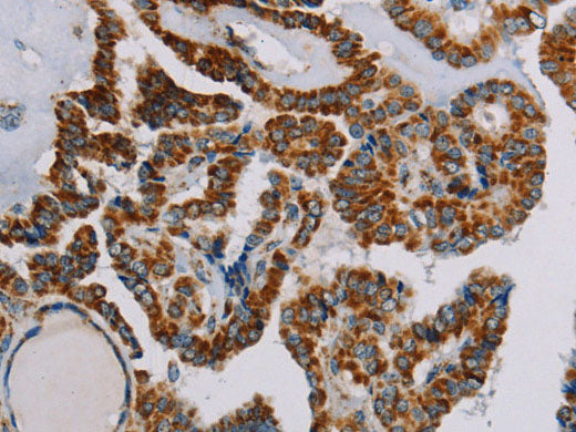 NDUFS3 Polyclonal Antibody Store at -20°C