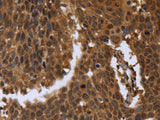 FGFRL1 Polyclonal Antibody