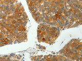 SH-PTP1 Polyclonal Antibody