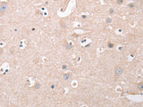 CDCA4 Polyclonal Antibody Store at -20°C