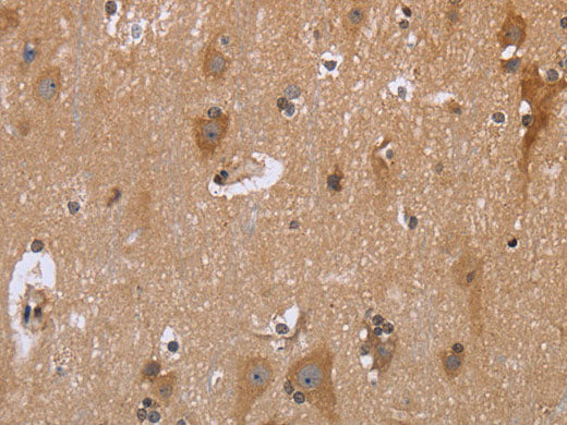 GABPB2 Polyclonal Antibody Store at -20°C