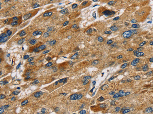 SULT1B1 Polyclonal Antibody Store at -20°C