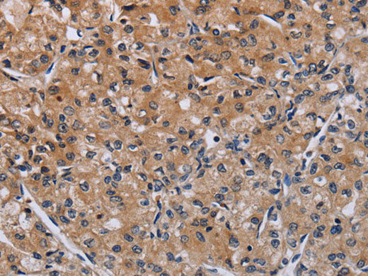 ACP6 Polyclonal Antibody Store at -20°C