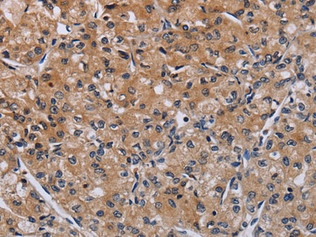 ACP6 Polyclonal Antibody Store at -20°C