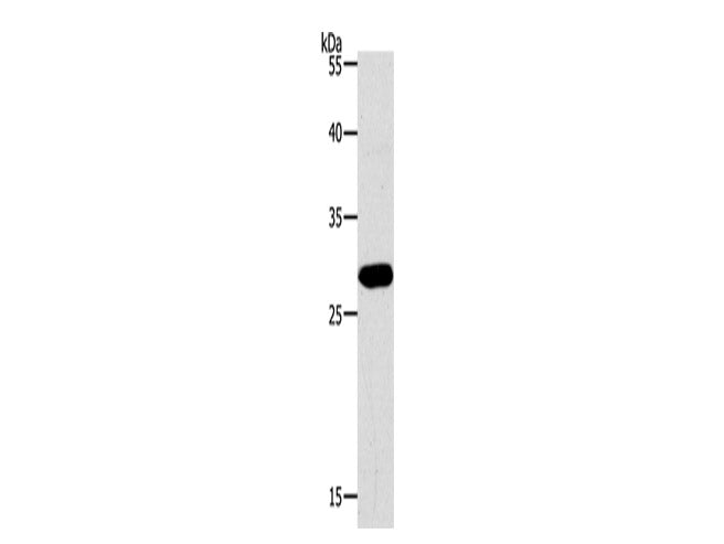 PAX5 Polyclonal Antibody Store at -20°C