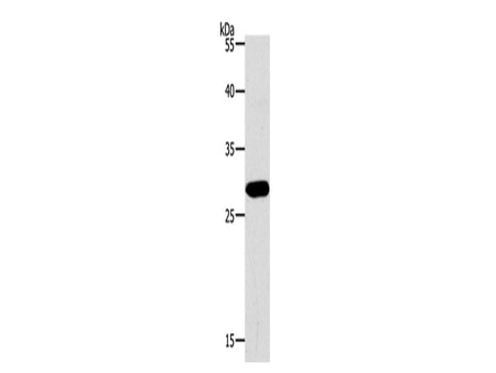 PAX5 Polyclonal Antibody Store at -20°C