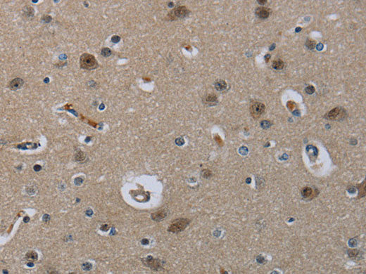 MRE11 Polyclonal Antibody Store at -20°C