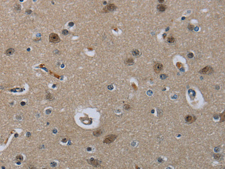 MRE11 Polyclonal Antibody Store at -20°C