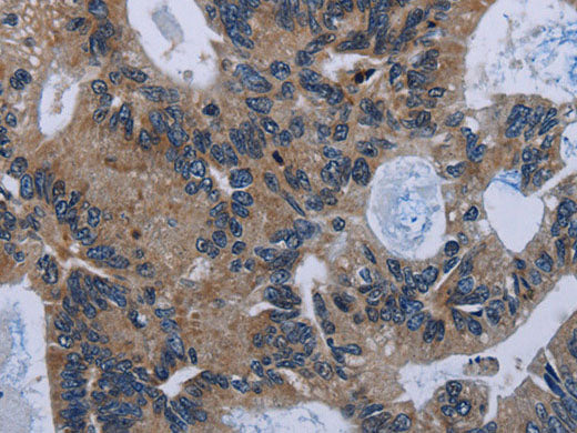 IRGM Polyclonal Antibody Store at -20°C