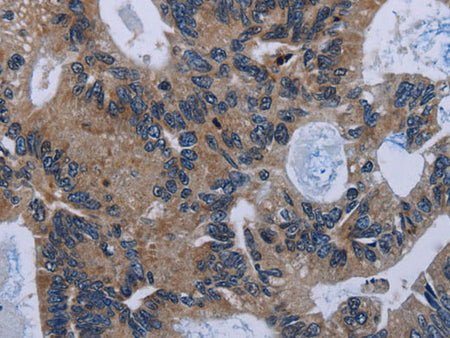 IRGM Polyclonal Antibody Store at -20°C