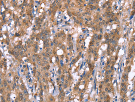 GPC6 Polyclonal Antibody Store at -20°C