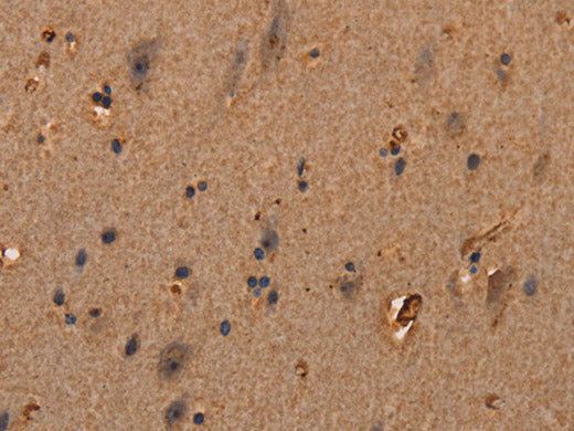 COL18A1 Polyclonal Antibody Store at -20°C