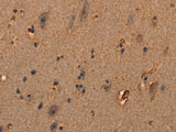 COL18A1 Polyclonal Antibody Store at -20°C