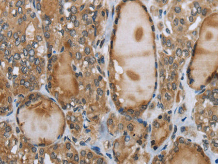 GGT1 Polyclonal Antibody Store at -20°C