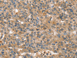 SSX2IP Polyclonal Antibody Store at -20°C