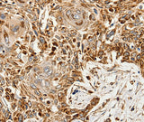 SLC9A7 Polyclonal Antibody Store at -20°C
