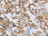 IL12RB2 Polyclonal Antibody Store at -20°C