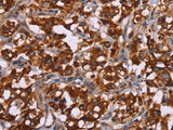 CYP2W1 Polyclonal Antibody