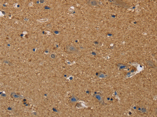 DDAH1 Polyclonal Antibody Store at -20°C