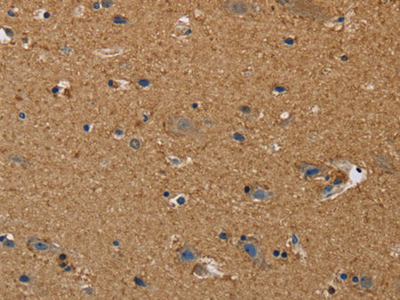 DDAH1 Polyclonal Antibody Store at -20°C