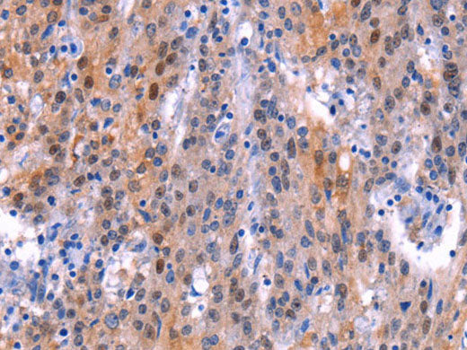 ADM2 Polyclonal Antibody