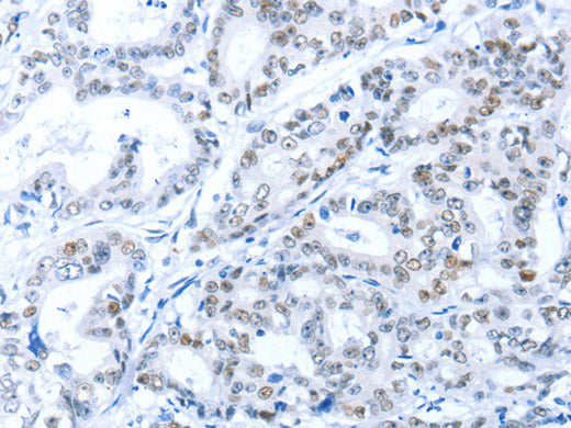 ARID1A Polyclonal Antibody Store at -20°C